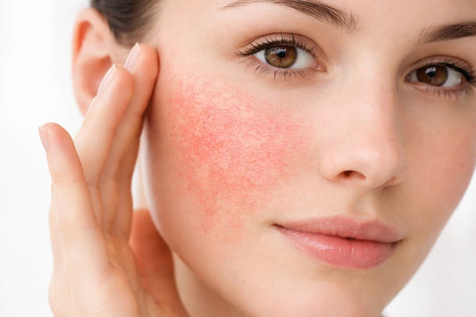 Bariera hydrolipidowa skóry twarzy