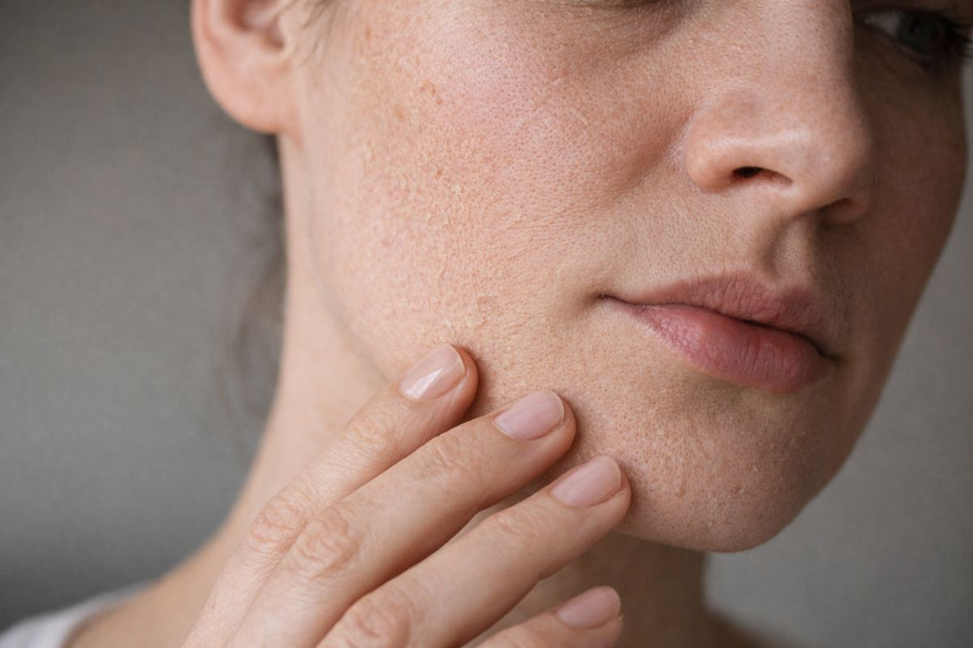 Skóra odwodniona VS sucha - jak rozpoznać i co robić?