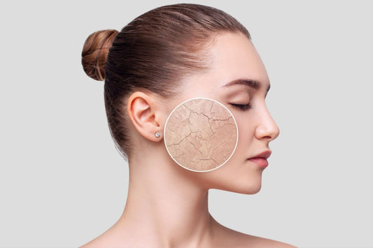 Łuszcząca się skóra twarzy z zaczerwienieniem