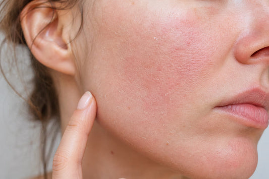 Retinol i krem barierowy w prostej rutynie pielęgnacyjnej